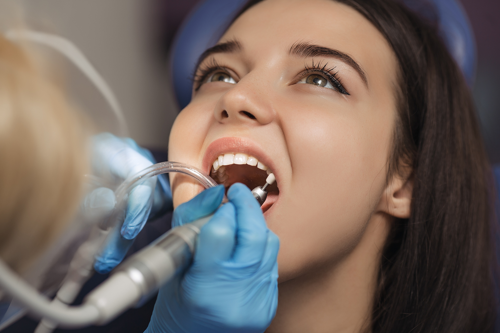 Essential Tips for a Smooth Recovery After a Root Canal Treatment